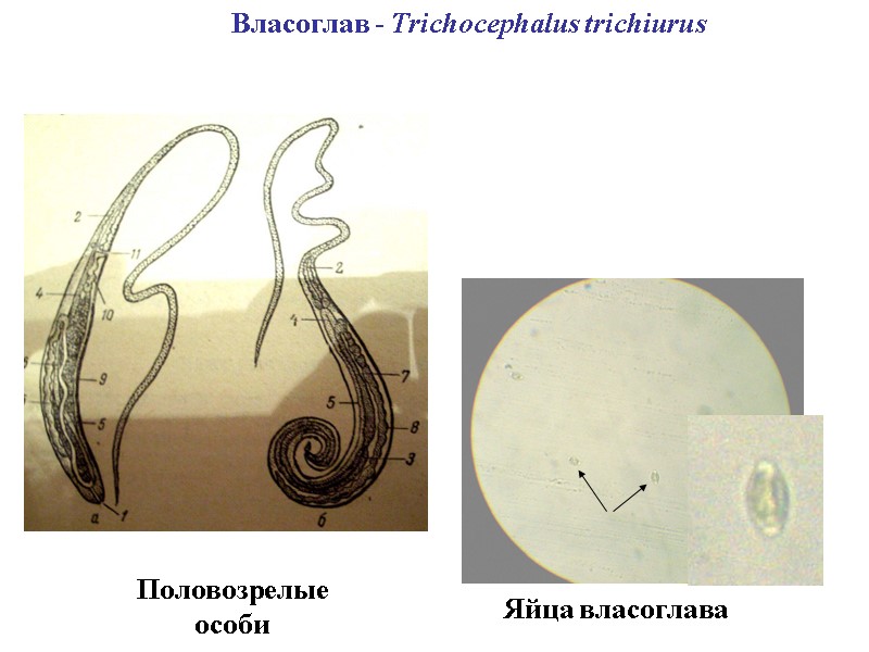 Власоглав - Trichocephalus trichiurus Яйца власоглава Половозрелые особи